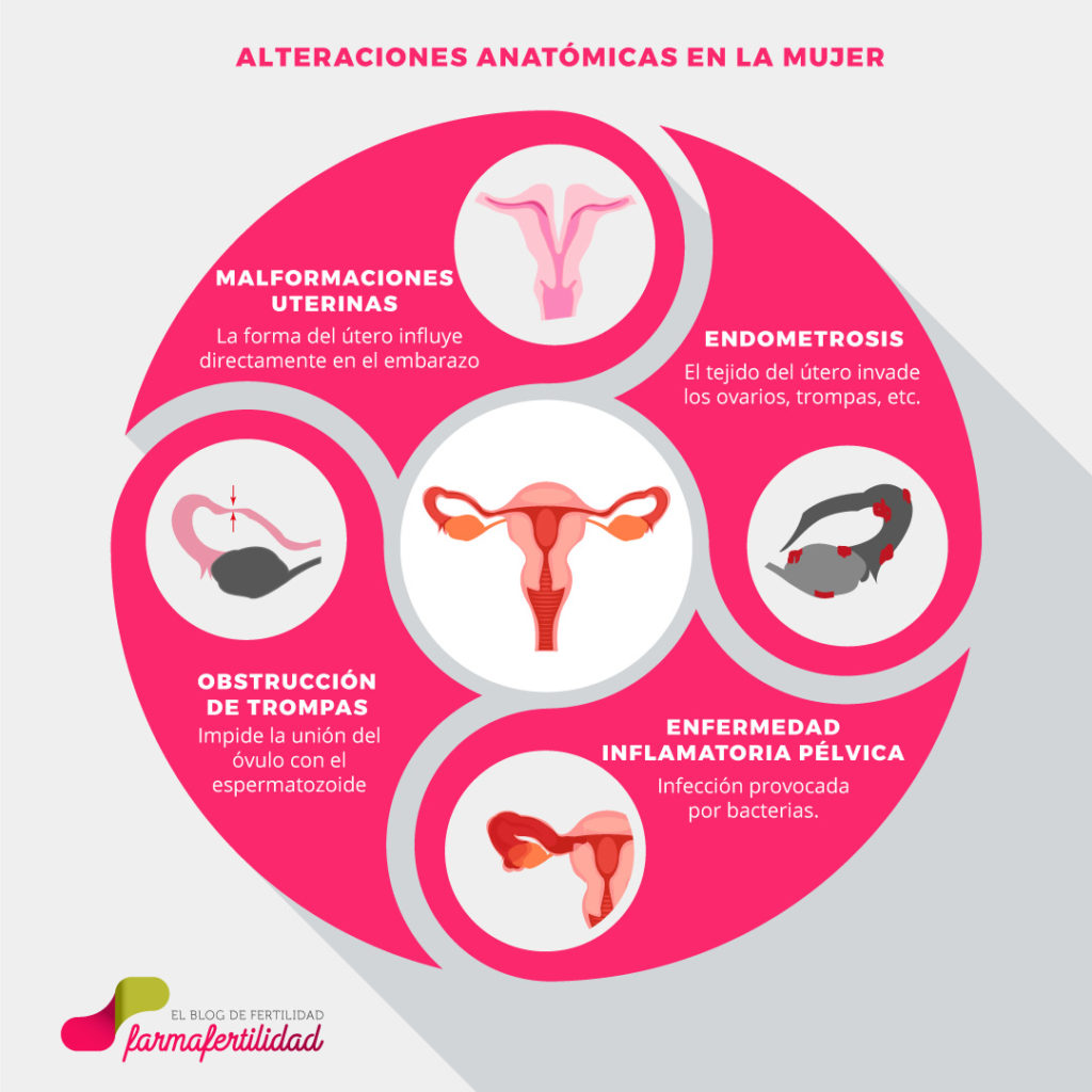 Alteraciones de la anatomía que afectan a la fertilidad Farma fertilidad